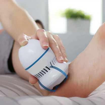 Vacuum Callus Remover
